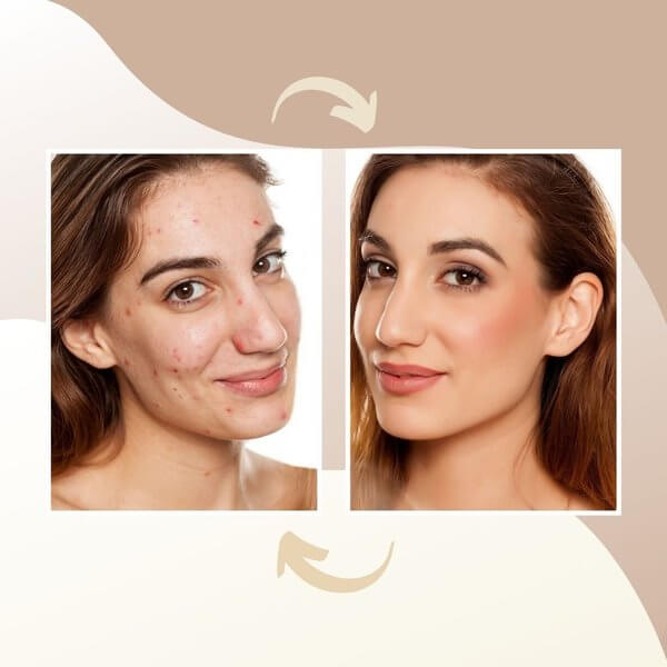 Skinpicking-Spiegel-Frau – Test eine junge Frau, die in den Spiegel schaut, gestützt auf ihre Ellenbogen, lächelt freudig in ihr Spiegelbild